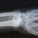 The Ultimate Guide to Personal Injury Law!