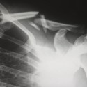 Find Your Perfect Personal Injury Leads Partner!